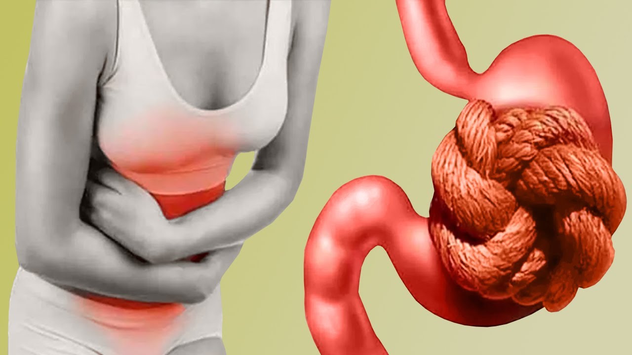 Understanding Common Digestive Problems